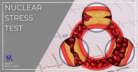 causes of heart rate dropping during stress test|abnormal blood pressure during stress testing.